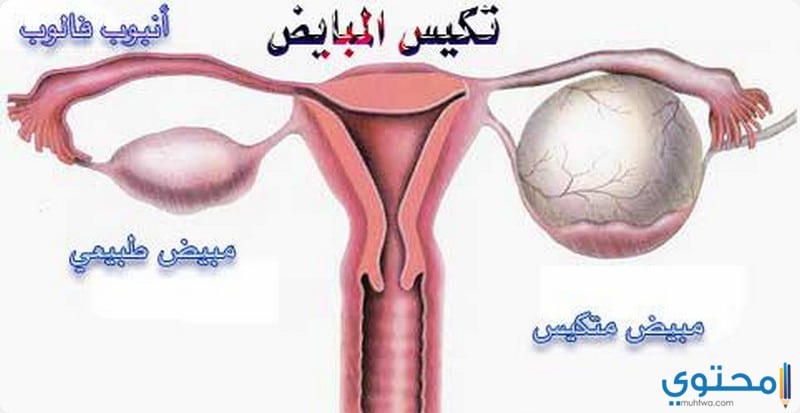 ما هي اسباب تاخر الدورة الشهرية مع عدم وجود الحمل - اضرابات الدورة الشهرية عند المراة 12389 1