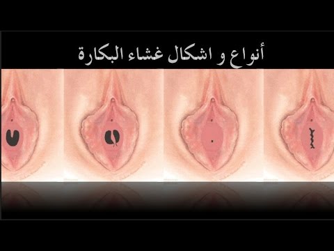 الفرق بين دم الدورة ودم الحمل - تعرفوا علي الفرق بين دم الدورة ودم الحمل 2646 1