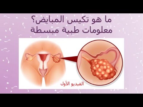 علاج التكيس , ما هو التكيس