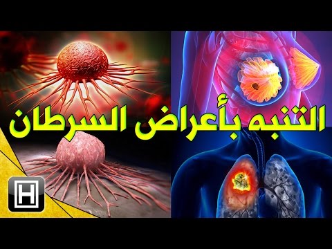 علاج مرض السرطان , تعرف علي مسببات مرض السرطان