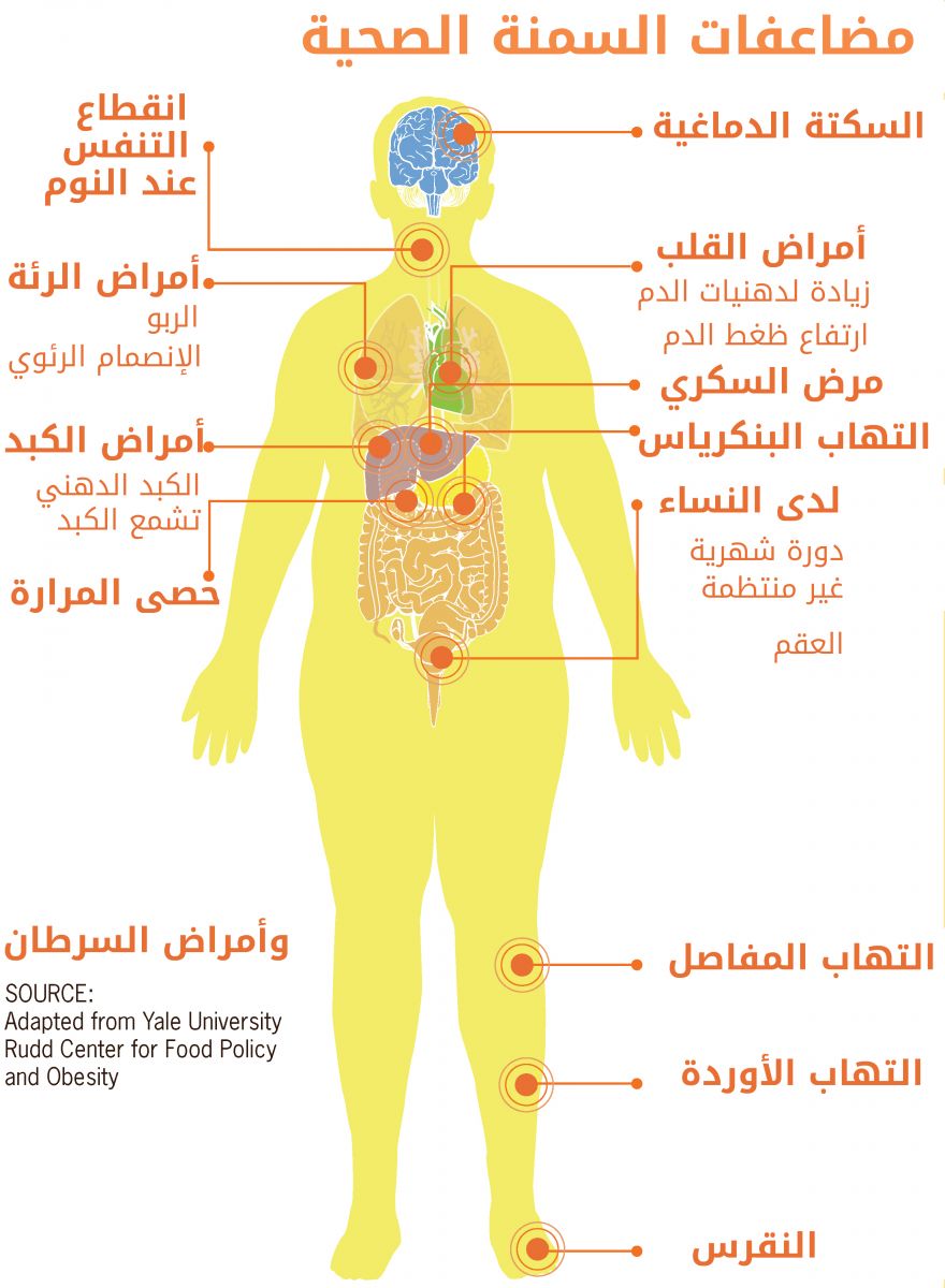 موضوع عن السمنة - ماهي اسباب السمنة 12822 2