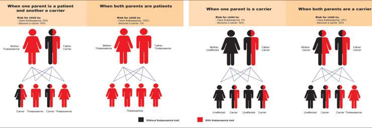 مرض الثلاسيميا - ماهو مرض الثلاسيميا 2816 2