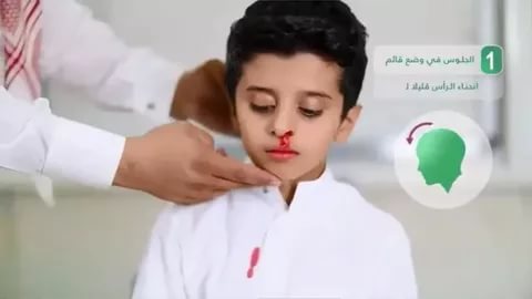 نزيف الانف , ماهي اعراض نزيف الانف