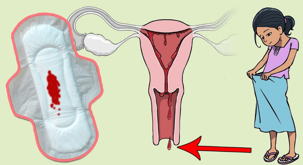 ماذا يحدث عند نزول الدورة الشهرية