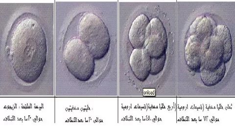 عند تلقيح البويضة ماذا تشعر المراة - تلقيح البويضة 2229 4