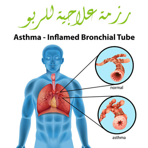 علاج الربو - طرق علاج الربو 3997 2