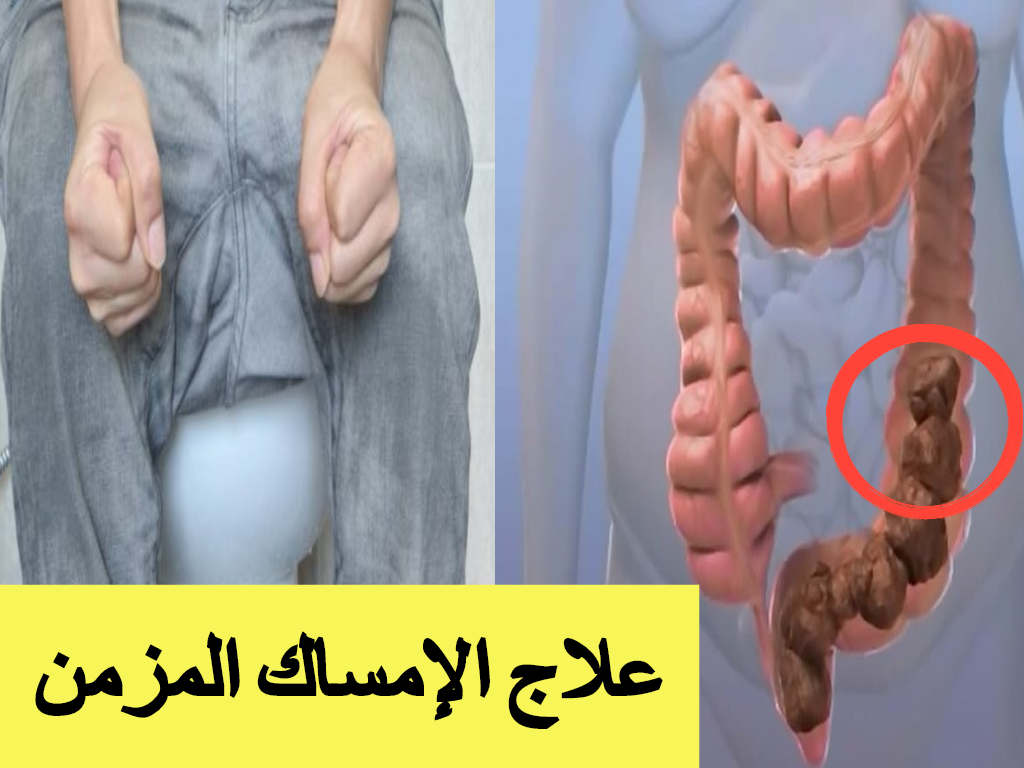 علاج الامساك , افضل علاج للامساك