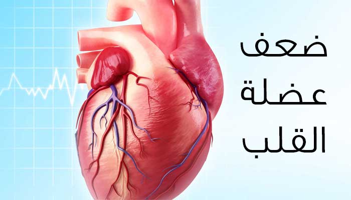 علاج قصور عضلة القلب , ما هي اسباب ضعف عضلة القلب